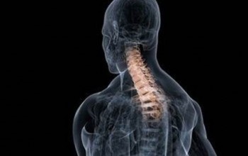 Lordoza patologică și normală a coloanei vertebrale provoacă, simptome, tratament, chirurgie, exerciții