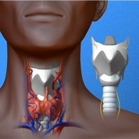 Carcinom cu celule scuamoase sau tumori maligne operabile - bisturiu - medical