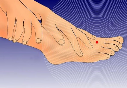 Tulburări și amorțeală la nivelul mâinilor și picioarelor cauzei