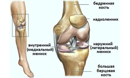 Deteriorarea diagnosticului, tratamentului meniscului la nivelul genunchiului medial