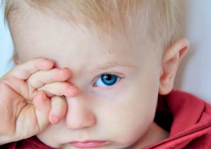 Probleme cu ochii strabismului copilului, ochi galbeni, nava sparge