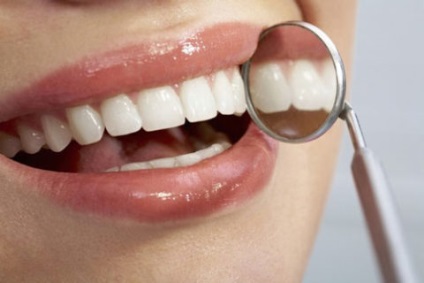 Câte gume vindecă după extracția dinților - etapele vindecării țesuturilor moi și osoase