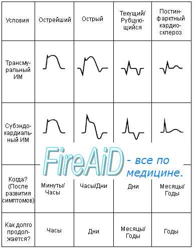 Spinală (specială) angina pectorală (stenocardia princemetal)