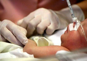 Convulsii la nou-născuți