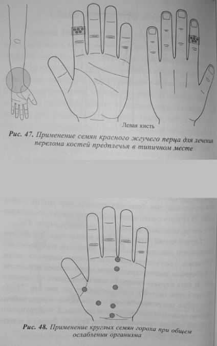 Terapia Su-jok - teoria a 5 elemente primare și 6 energii, terapia cu culori, terapia cu semințe