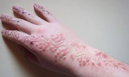 Tetoválás, mint káros, és milyen következményekkel járhat