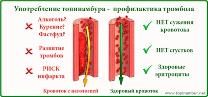 Ierusalimul în hrana animalelor