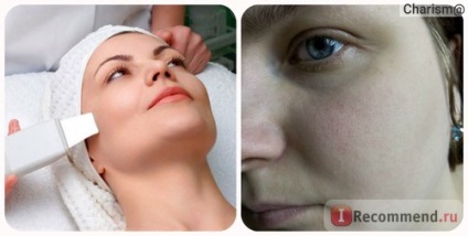Curățarea cu ultrasunete a feței - 