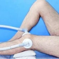 Meniscul articulației genunchiului cade - bisturiul - portalul informațional și educațional medical