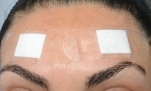 Vitaminele din riduri - aplicație pentru față, în jurul și sub ochi