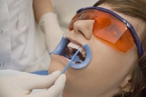 Restaurarea dinților prin construcție, revizuirea metodelor, prețurilor și recenziilor