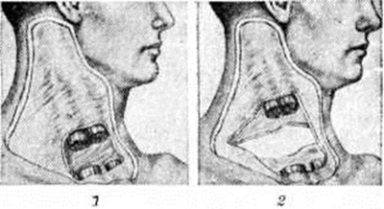 Simptome congenitale torticolice musculare, diagnostic, tratament