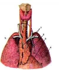 Aplasia de timus