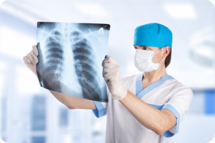 Simptome de azbestoză, diagnostic, tratament, eurolab, pulmonologie
