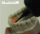 Dental-revue, galerie foto, laborator dentar vital