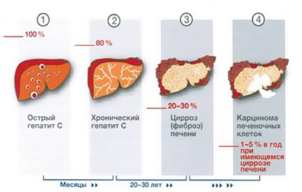 Dieta cu hepatită cu principiile nutriției corecte, ce pot și nu pot fi consumate, un meniu aproximativ și