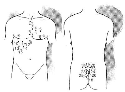 Hirudoterapia cu insuficiență cardiacă