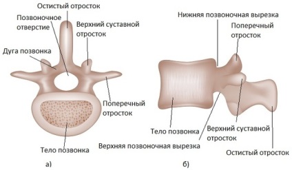 Disc herniat