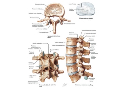 Disc herniat