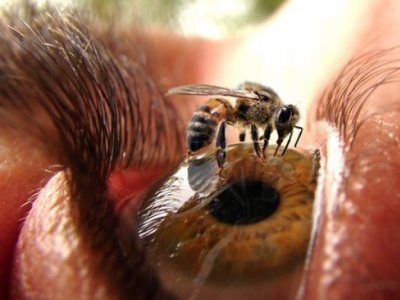 Cum și ce să eliminați umflarea după înțepăturile de albine