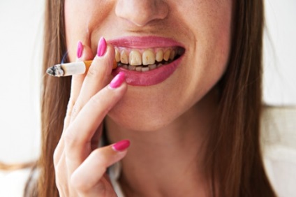 Cum fumatul afectează dinții