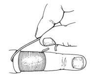 Cum să eliminați inelul de pe un deget umflat - 10 moduri