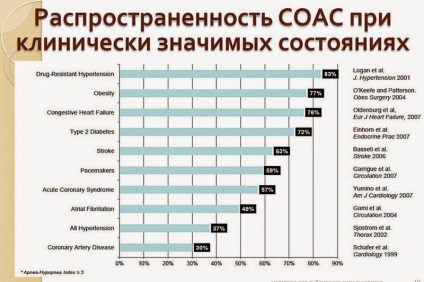 Cum pot afla sforăitul sau o diferență de apnee de 20 de ani de viata, doctorul Andrew beloveshkin resurse de sănătate