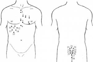 Tratamentul cu lipitori ai insuficienței cardiace - hirudoterapie - site medical