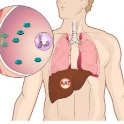 Pulmonális elégtelenség, tünetek, kezelés - szike - orvosi információk - oktatási