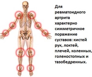 Metode pentru diagnosticarea bolilor articulare