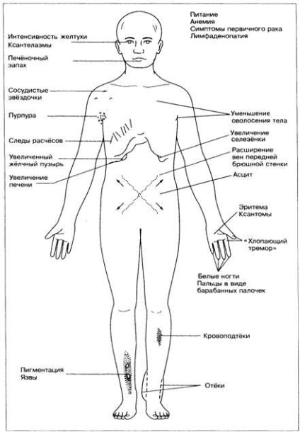 Verificați icterul - pagina 2