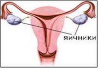 Insuficiența ovariană primară ca cauză a infertilității