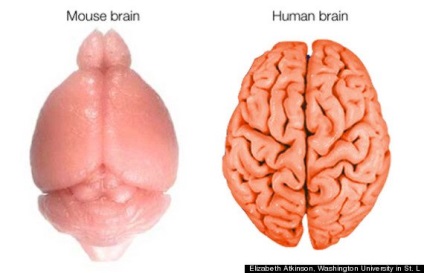 De ce creierul nostru este atât de tortuos?