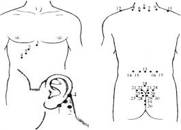 Lipitoare cu hipertensiune arterială - tratament cardiac