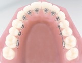 Puneți bretele pe dinți - un ortodont de copii în Kazan