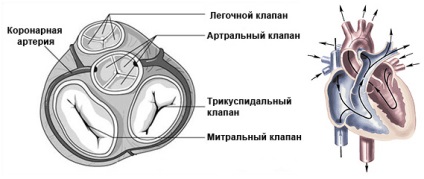 Szerzett szívhibák (primer mitralis regurgitáció) Szerzett szívbetegségek