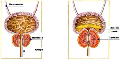 Diagnosticul, tratamentul și prevenirea prostatitei, Moscova