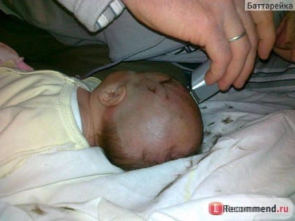 Punctul cefalosanatomului la nou-născut - 