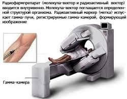 Radionuclide Diagnostics