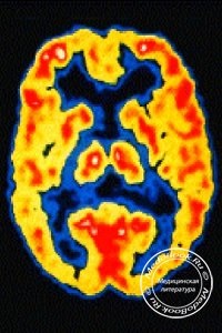 A központi idegrendszer sérüléseinek és betegségeinek radionuklid diagnosztikája, orvosi ellátás