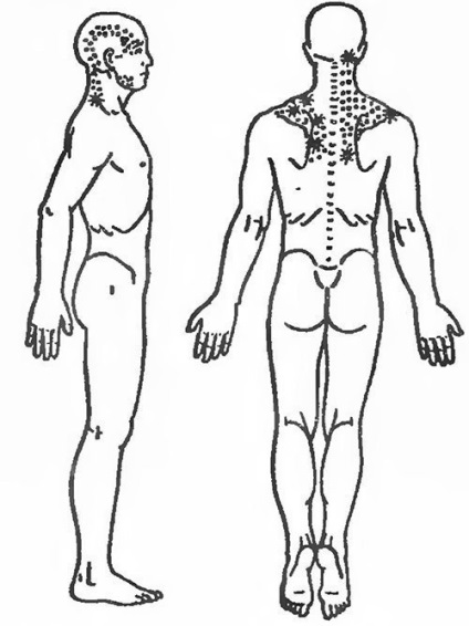 Stretching al muschilor umărului cu dureri de spate