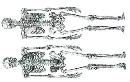 A legerősebb csont anatómiája