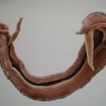 Schistosomiasis simptome, tratament și fotografii de schistosomes (paraziți)