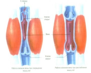 Crampe musculare, blogul lui Max obukhov, formare competentă de la A la Z