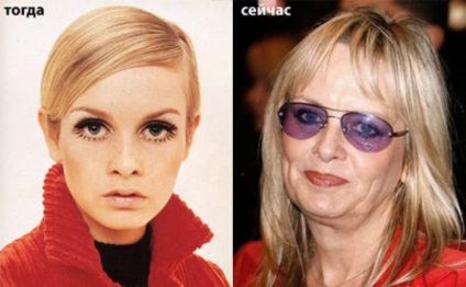 Supermodelul Twiggy - icon stilul anilor 1960, sau în subtirimea vogă și tunsori scurte