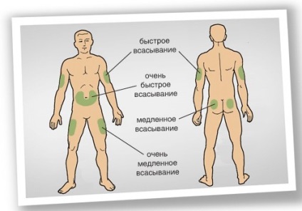 Tehnica administrării insulinei