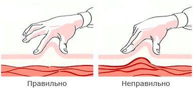 Техника инсулин