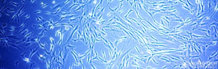 Tipuri de celule stem