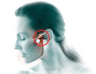 Maxillofacial terület gyulladásos betegségei