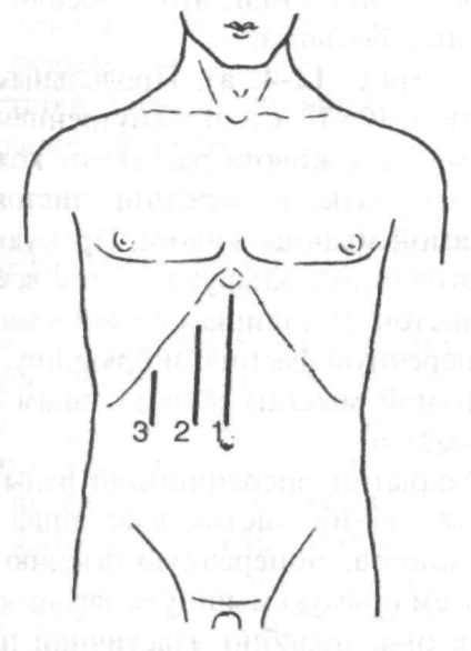 Accesul chirurgical la organele cavității abdominale